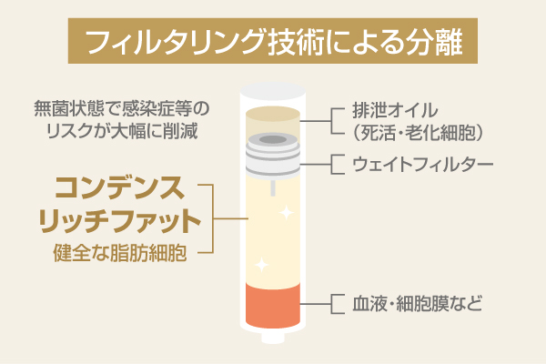 脂肪注入法